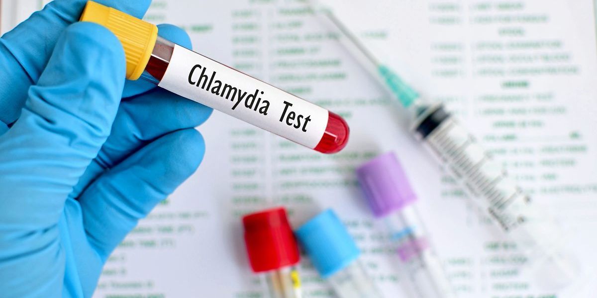 Chlamydien woher kommen ᐅ Chlamydien