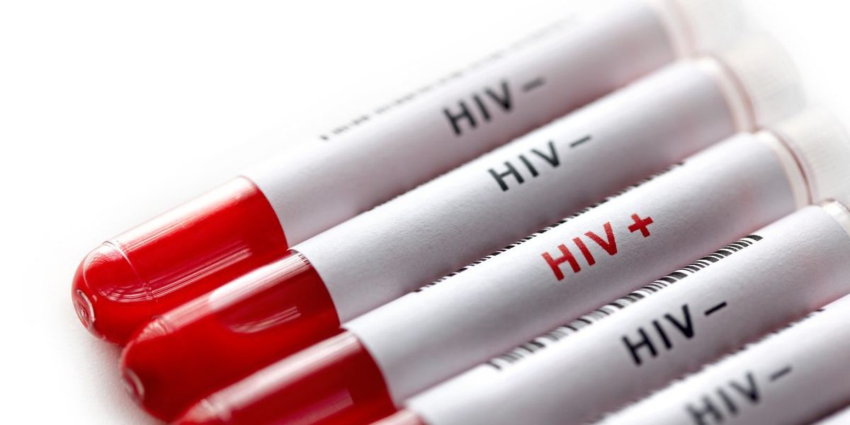 Bekommen kann hiv wenn partner hiv hat kein man HIV (AIDS)