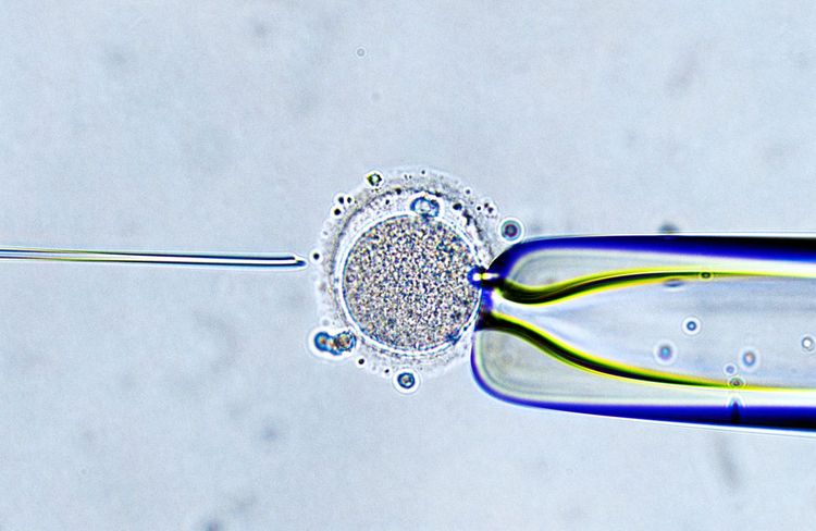 In-Vitro-Fertilisation, IVF, künstliche Befruchtung, Eizelle