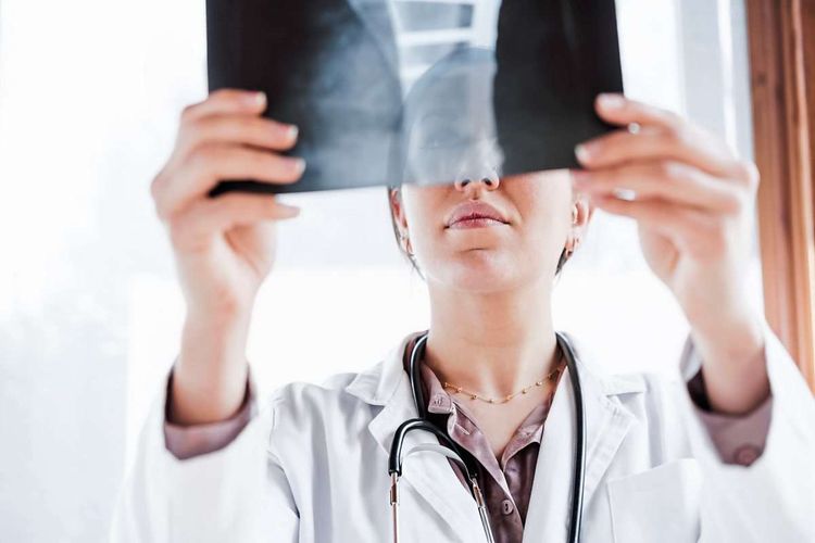 Ein Ärztin sieht sich ein Röntgenbild an.