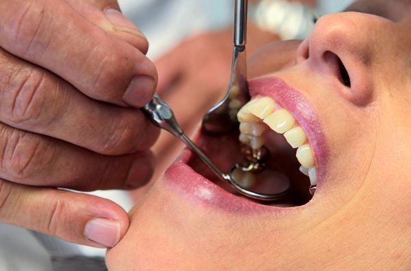 Prozess-gegen-schwerh-rigen-Zahnarzt-dessen-Implantat-in-Kieferh-hle-wanderte