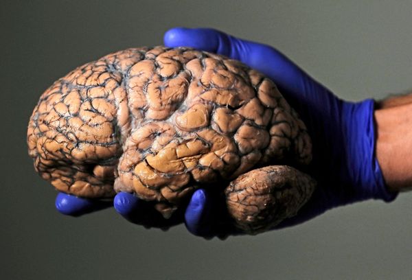 Psychopathische-Z-ge-lassen-sich-im-Gehirn-ablesen