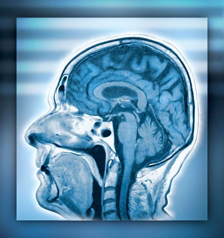 Ein Querschnitt durch einen menschlichen Kopf, in dem das Gehirn gut sichtbar ist.