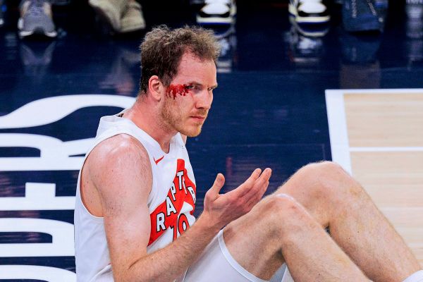 Basketballer-P-ltl-erlitt-Cut-bei-Torontos-NBA-Niederlage-gegen-LA