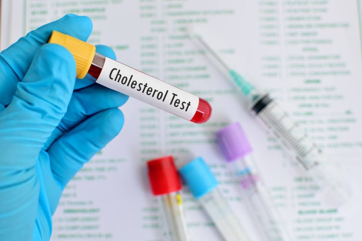 Cholesterinsenker werden zu häufig verschrieben Gesundheit derStandard.de › Wissen und Cholesterinsenker werden zu häufig verschrieben Gesundheit derStandard.de › Wissen und