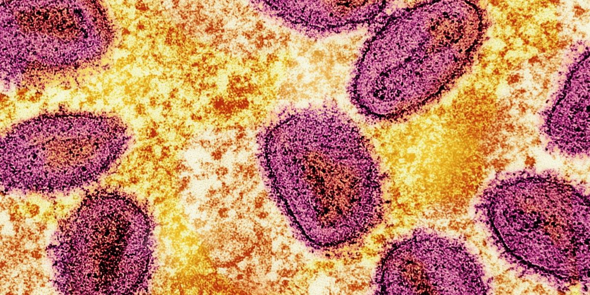 Semen can promote Mpox infection