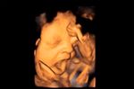 Selbst Föten im Uterus lassen sich vom Gähnen der Mutter anstecken