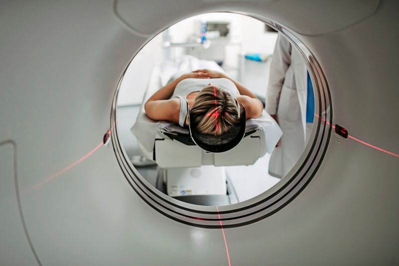 KI reduziert Strahlenbelastung bei Tomografien um bis zu 70 Prozent