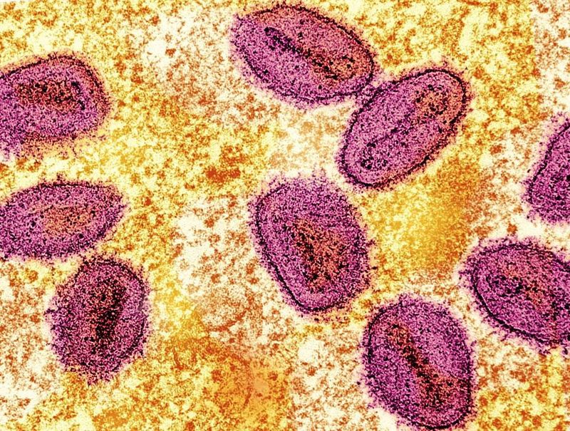 Erstmals neue Mpox-Variante in den USA nachgewiesen