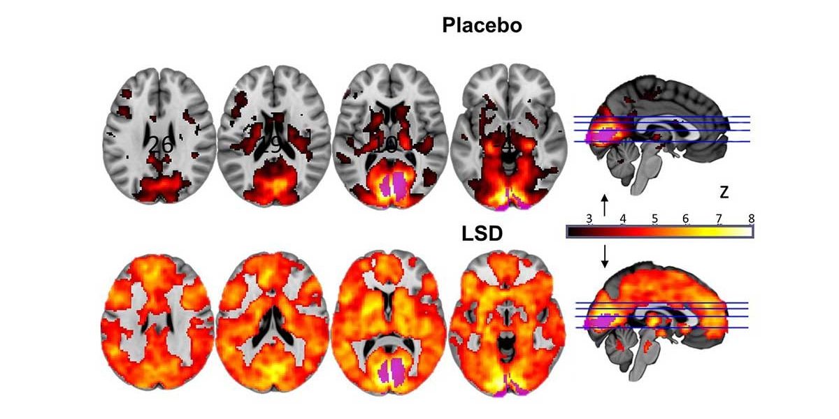 Erste wissenschaftliche Studie zu mikrodosiertem LSD startet - Mensch