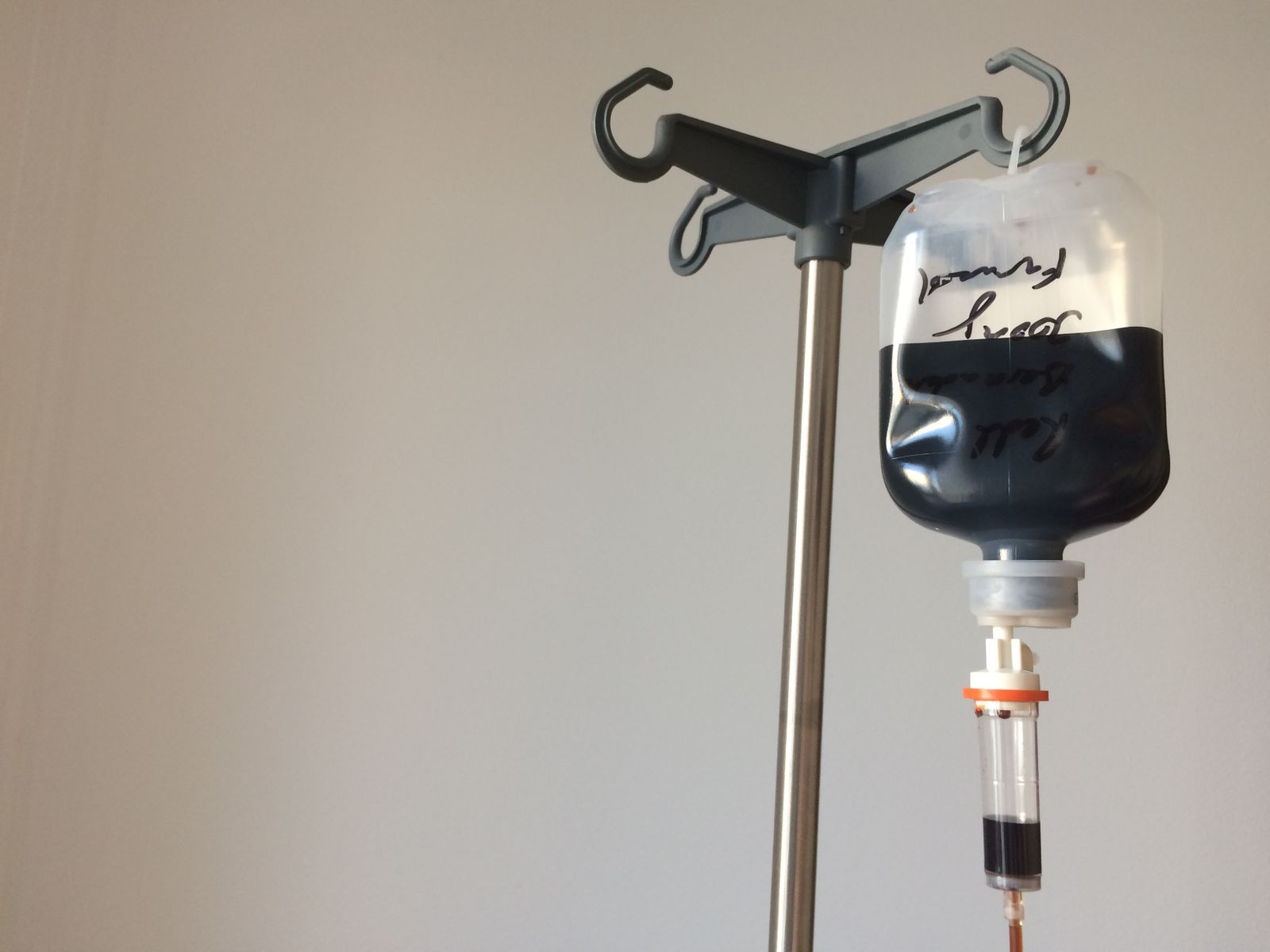 Am Tropf hängen Wenn der Eisenspeicher aufgefüllt werden muss Gesundheit derStandard.de