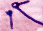 Ebola-infizierter Amerikaner soll in Deutschland behandelt werden