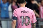 Argentinien sorgt sich um angeschlagenen Messi