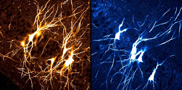 Zwei mikroskopische Aufnahmen eines CA3-Pyramiden-Neuronennetzwerks im Hippocampus von Mäusen. Links: Dichtes, gelbes Netzwerk junger Mäuse. Rechts: Spärlicher, aber strukturierter und verfeinerter blauer Neuronenaufbau bei älteren Mäusen.
