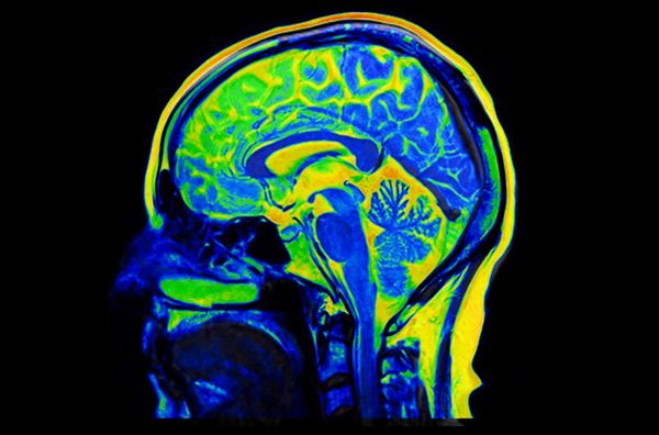 Wiener-Forschende-wollen-R-tsel-um-Alzheimer-und-Parkinson-knacken