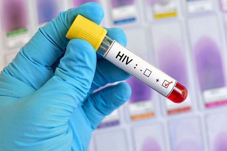 Hand mit blauen Gummihandschuhen hält eine HIV-positive Blutprobe