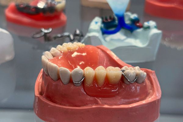 Vier-Gebisse-zehn-H-rger-te-Das-wurde-2025-in-BB-Z-gen-gefunden