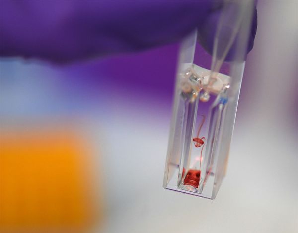 Früherkennung von Krebs durch neuartigen Bluttest macht Hoffnung