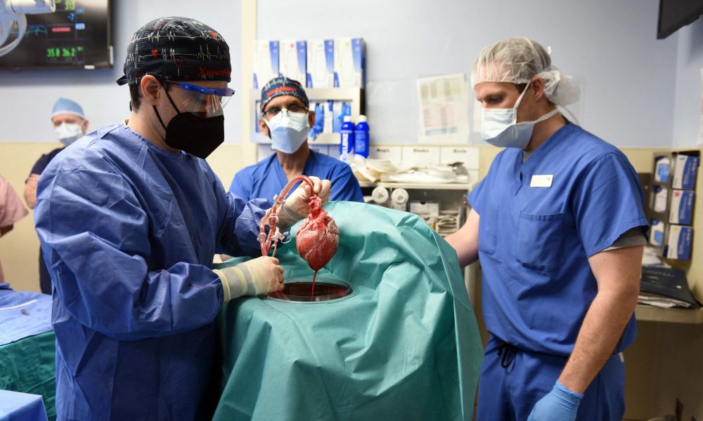 US physicians successfully used pig hearts for the first time – world chronicle