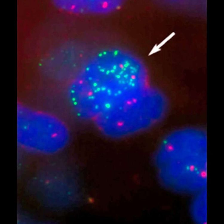 Neuroblastom-Zellen unter dem Mikroskop