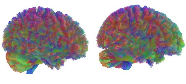 Unser-Hirn-ndert-sich-viermal-mit-etwa-neun-32-66-und-83-Jahren