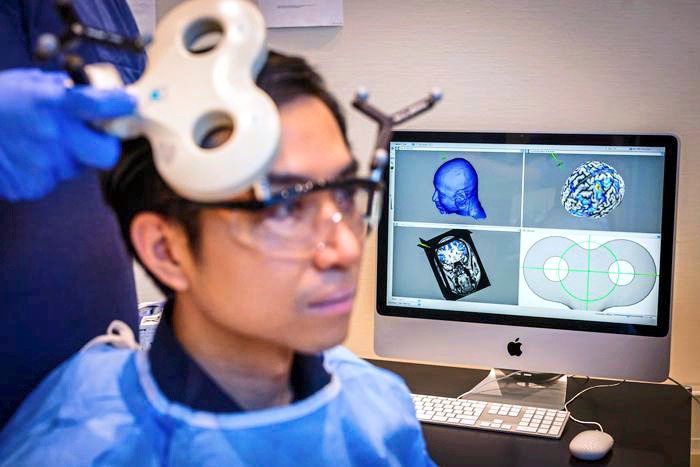 Forscher erzeugten Großzügigkeit mit elektrischen Impulsen im Gehirn