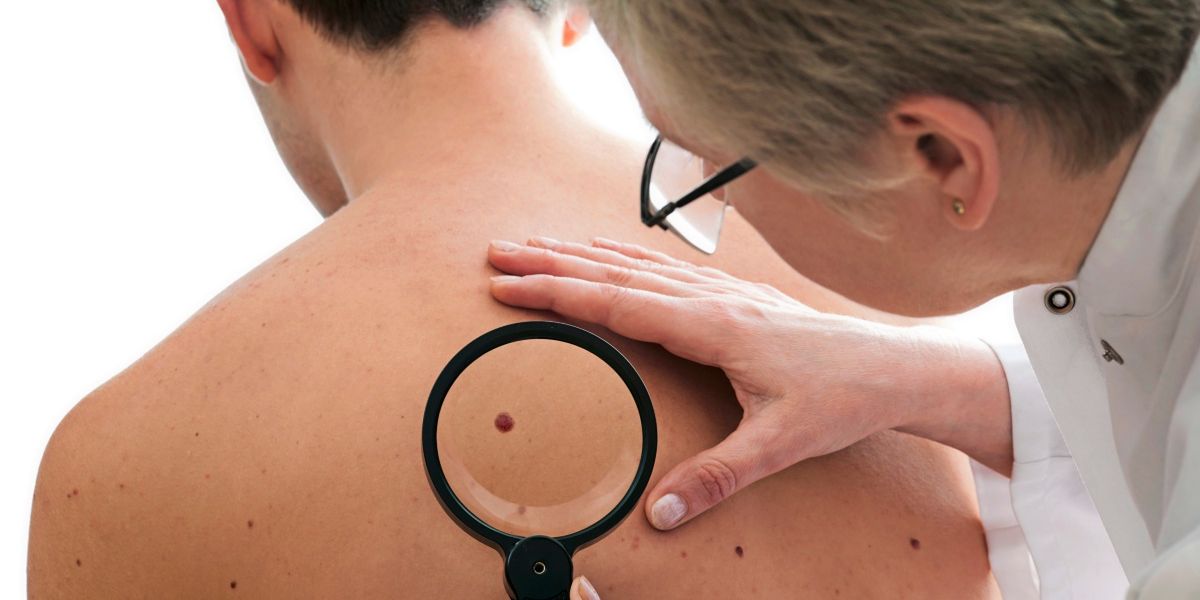 Merck and Moderna successfully test skin cancer vaccine