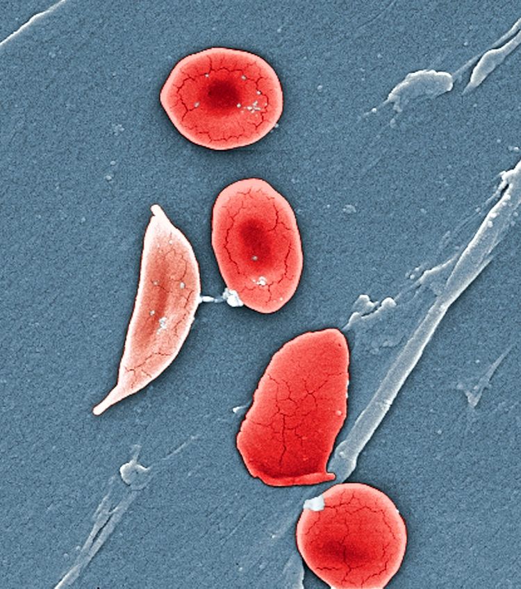 Runde, ovale und länglich verzogene rote Blutkörperchen auf graublauem Hintergrund