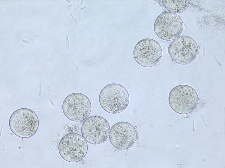 Juno Ermoglicht Die Verbindung Von Spermium Und Eizelle Mensch Derstandard At Wissenschaft