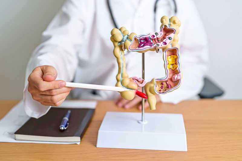 Die Entwicklung neuer Therapien gegen Darmkrebs dauert zu lange