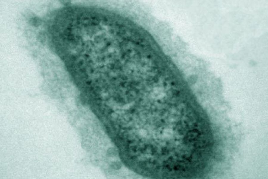 Archaeen finden im menschlichen Körper gute Bedingungen vor Mensch